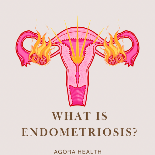 Endometriosis: the real struggle.